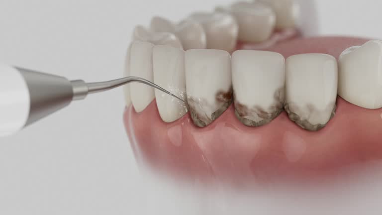 Reliable Emergency Dentist contractor in Fallbrook, CA by Smile Center Dentistry